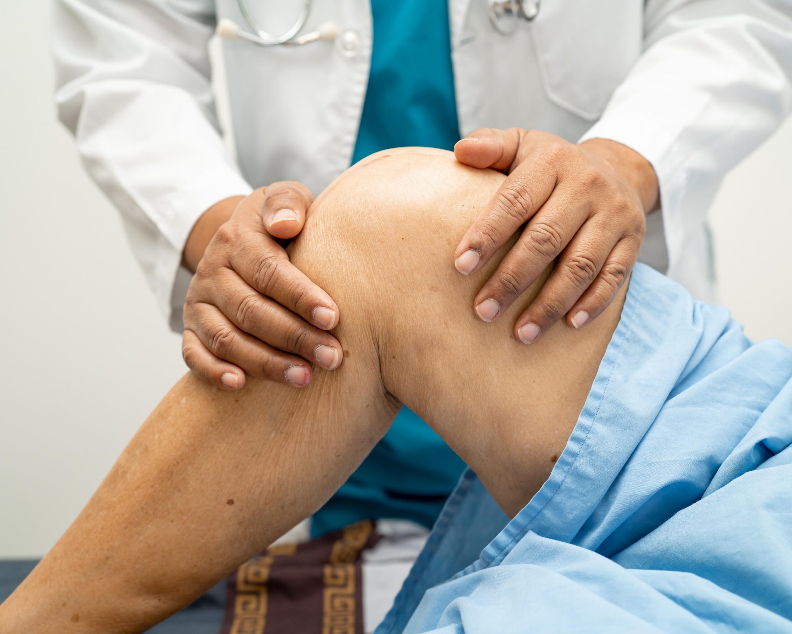 Why Do Varicose Veins Hurt? Understanding the Pain and Methods of Relief Image
