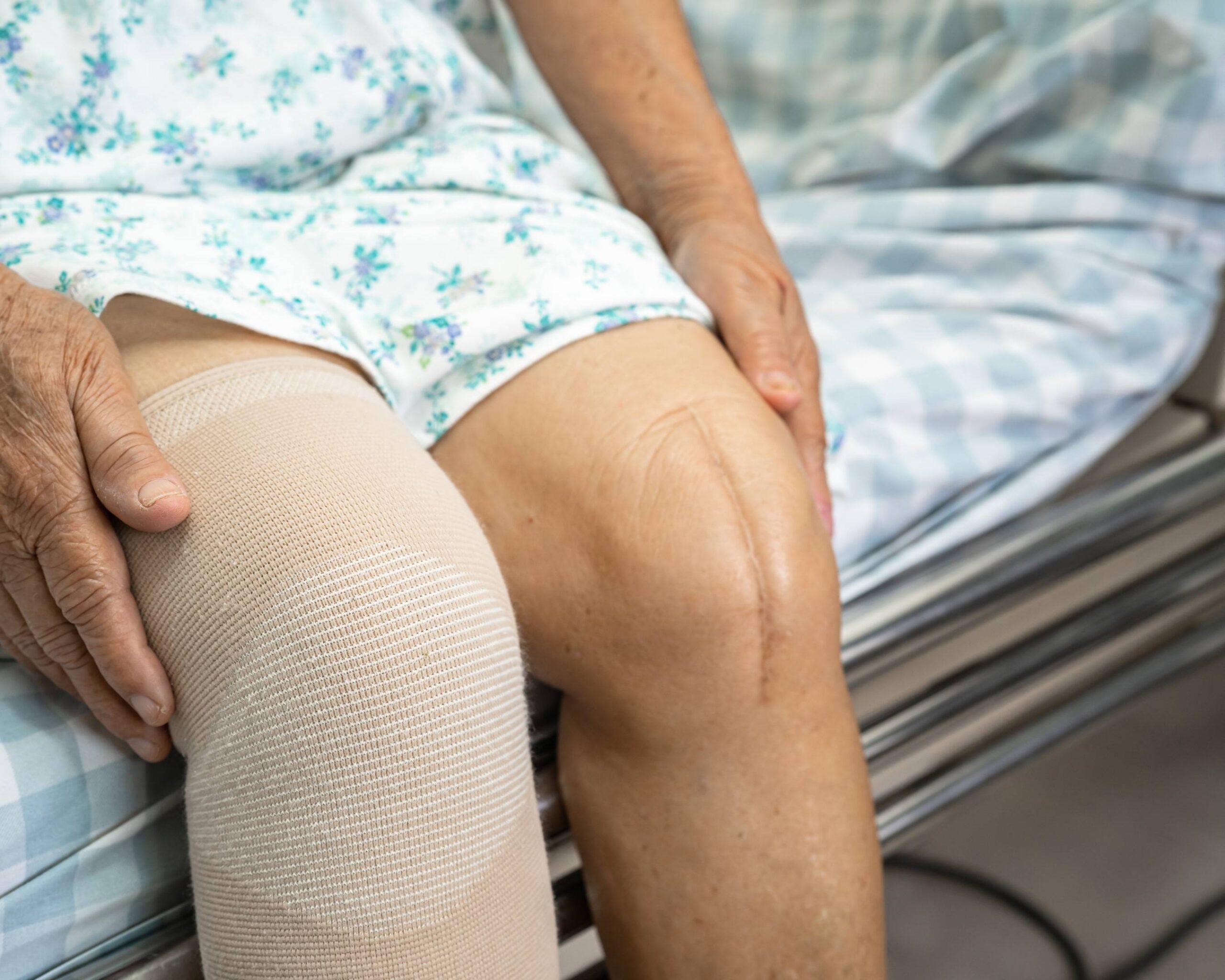 Think Veins First: Reducing Swelling After Knee Replacement Image