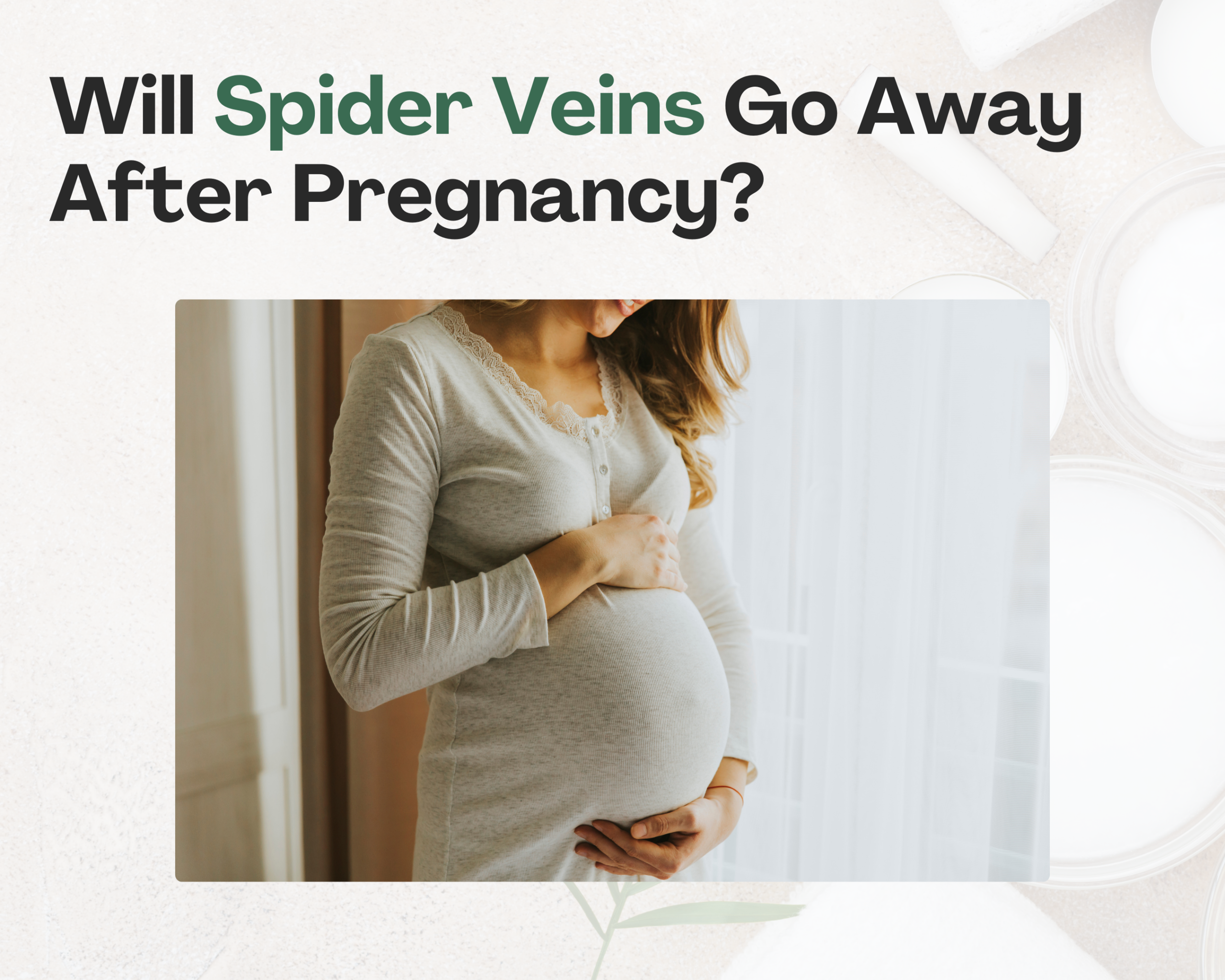 Will Spider Veins Go Away After Pregnancy? Image