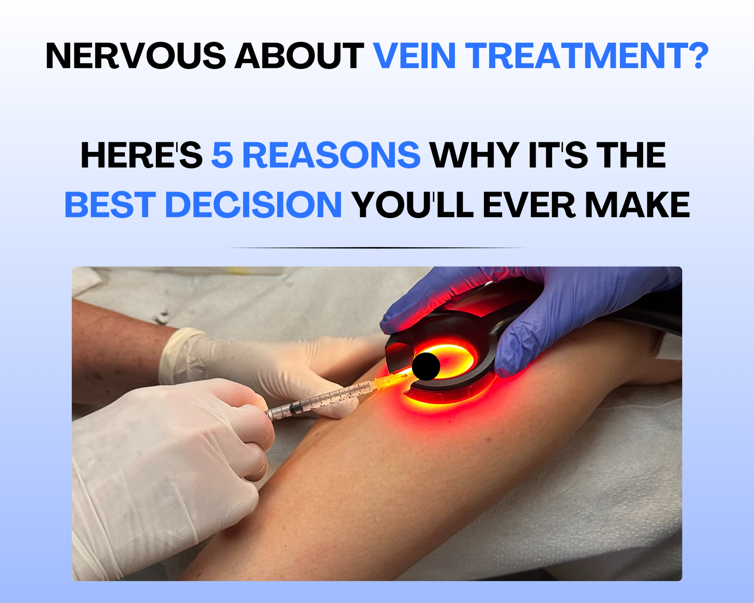Nervous About Vein Treatment? Here Are 5 Reasons Why It’s the Best Decision You Could Make Image