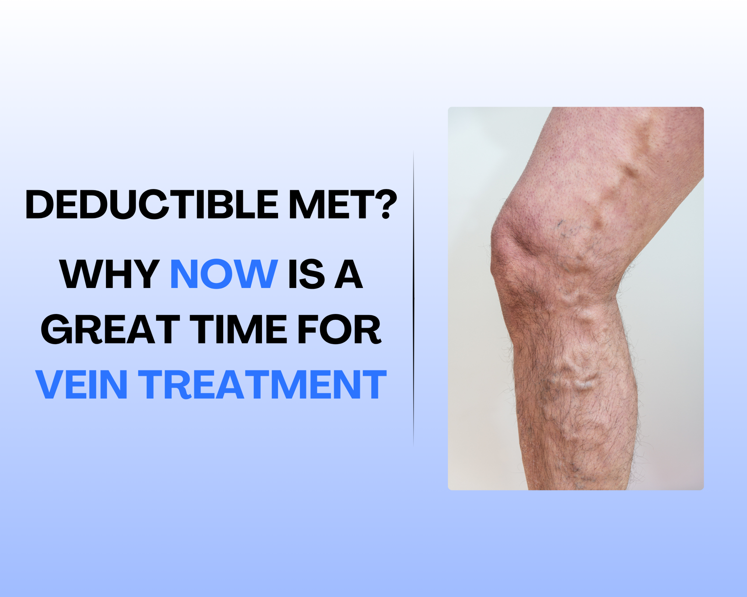 Deductible Met? Then Now Is a Great Time for Vein Treatment Image
