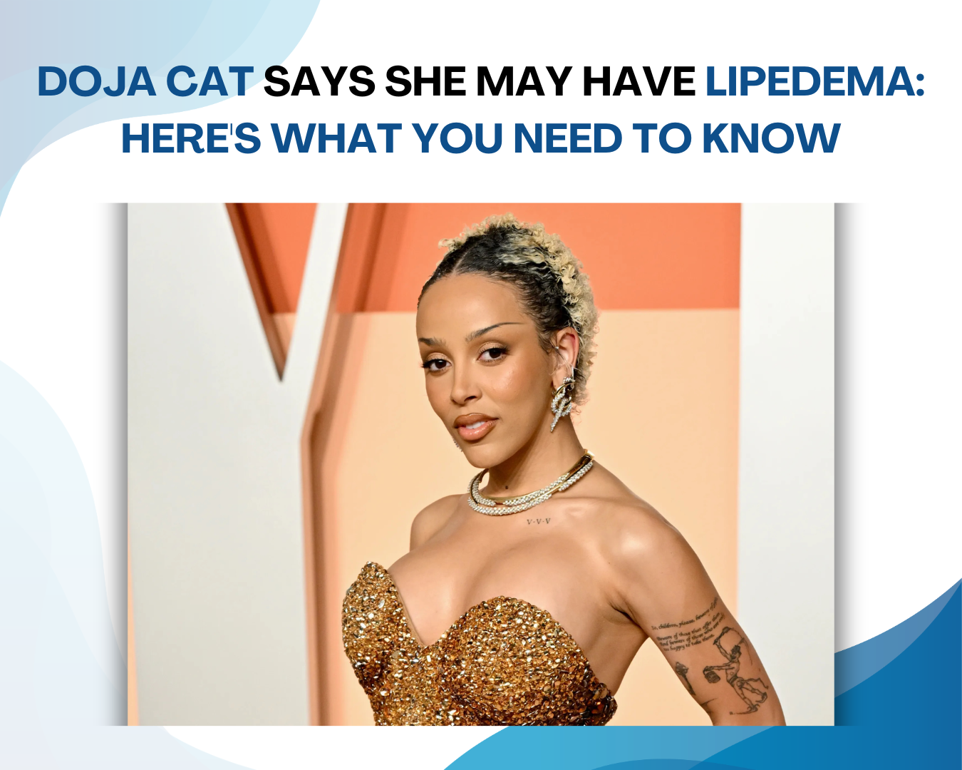 Doja Cat Says She May Have Lipedema: Here’s What You Need to Know Image