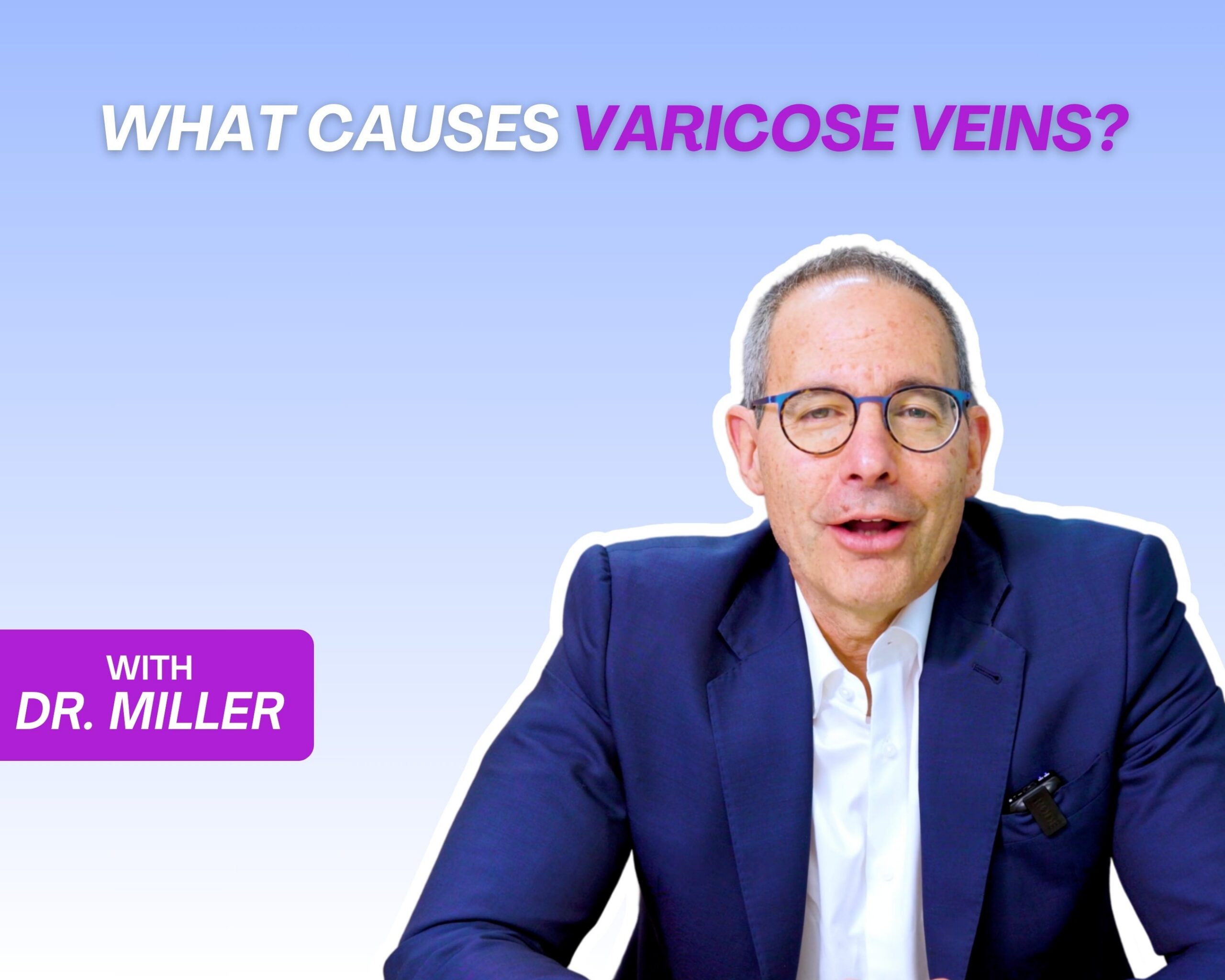 What Causes Varicose Veins? Image